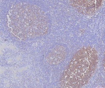 IHC staining of FFPE human tonsil tissue with BOB1 antibody (clone BOB1/7469). HIER: boil tissue sections in pH 9 10mM Tris with 1mM EDTA for 20 min and allow to cool before testing.~