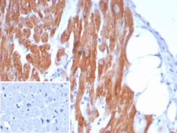 IHC staining of FFPE human heart tissue with Crystallin Alpha B antibody (clone CRYAB/7917). Inset: PBS used in place of primary Ab (secondary Ab negative control). HIER: boil tissue sections in pH 9 10mM Tris with 1mM EDTA for 20 min and allow to cool before testing.~
