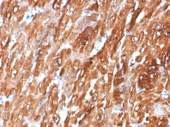 IHC staining of FFPE human heart tissue with Crystallin Alpha B antibody (clone CRYAB/7918). HIER: boil tissue sections in pH 9 10mM Tris with 1mM EDTA for 20 min and allow to cool before testing.~