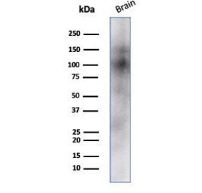 Western blot testing of human brain tissue lysate with CD56 antibody (clone NCAM/7523). Predicted molecular weight: ~110 kDa (soluble fragment), ~120/125 kDa (GPI-anchored), 140/180 kDa (transmembrane isoforms).~