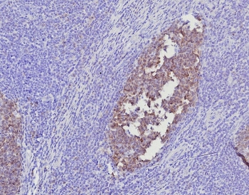 IHC staining of FFPE human tonsil tissue with BOB1 antibody (clone BOB1/7468). HIER: boil tissue sections in pH 9 10mM Tris with 1mM EDTA for 20 min and allow to cool before testing.~