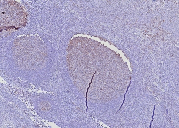 IHC staining of FFPE human tonsil tissue with BOB1 anti