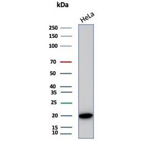 Western blot testing of human HeLa cell lysate with Crystallin Alpha B antibody (clone CRYAB/4666). Predicted molecular weight ~20 kDa.~