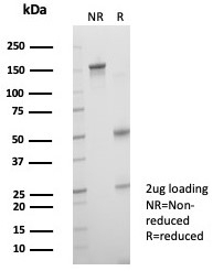 SDS-PAGE analysis of purified, BSA-free Crystallin Alpha B antibody (clone CRYAB/4666) as confirmation