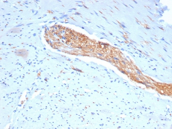 IHC staining of FFPE human colon tissue with CD56 antibody (clone NCAM/7522). HIER: boil tissue sections in pH 9 10mM Tris with 1mM EDTA for 20 min and allow to cool before testing.~