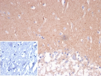 IHC staining of FFPE human cerebellum tissue with CD56 antibody (clone NCAM/7524). Inset: PBS used in place of primary Ab (secondary Ab negative control). HIER: boil tissue sections in pH 9 10mM Tris with 1mM EDTA for 20 min and allow to cool before testing.~