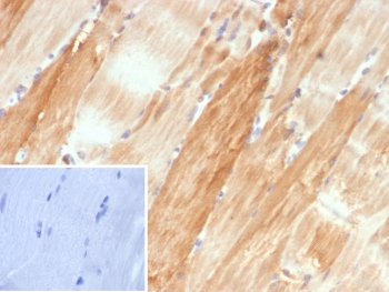 IHC staining of FFPE human skeletal muscle tissue with Crystallin Alpha B antibody (clone CRYAB/4662). Inset: PBS used in place of primary Ab (secondary Ab negative control). HIER: boil tissue sections in pH 9 10mM Tris with 1mM EDTA for 20 min and allow to cool before testing.~