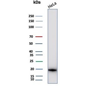 Western blot testing of human HeLa cell lysate with Crystallin Alpha B antibody (clone CRYAB/4659). Predicted molecular weight ~20 kDa.~
