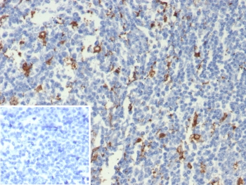 IHC staining of FFPE human tonsil tissue