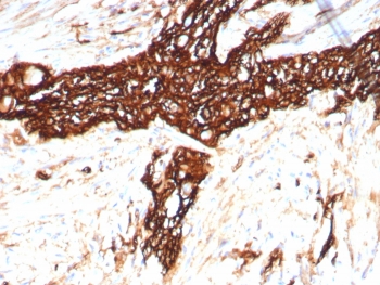 IHC staining of FFPE human colon tissue with recombinant NCAM antibody (clone rNCAM1/8758). HIER: boil tissue sections in pH 9 10mM Tris with 1mM EDTA for 20 min and allow to cool before testing.~