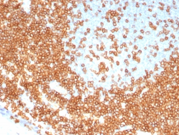 IHC staining of FFPE human tonsil tissue with recombinant CD3 epsilon antibody (clone C3e/8115R). HIER: boil tissue sections in pH 9 10mM Tris with 1mM EDTA for 20 min and allow to cool before testing.~