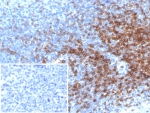 IHC staining of FFPE human tonsil tissue with CD3 epsilon antibody (clone rC3e/6966). Inset: PBS used in place of primary Ab (secondary Ab negative control). HIER: boil tissue sections in pH 9 10mM Tris with 1mM EDTA for 20 min and allow to cool before testing.