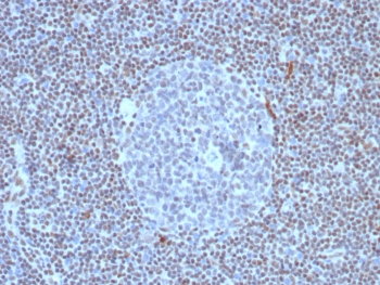 IHC staining of FFPE human lymph node tissue with recombinant FLI1 antibody (clone FLI1/8318R). HIER: boil tissue sections in pH 9 10mM Tris with 1mM EDTA for 20 min and allow to cool before testing.~
