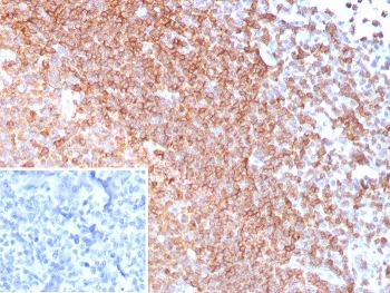 IHC staining of FFPE human tonsil tissue with CD185 antibody (clone CXCR5/8279R). Inset: PBS used in place of primary Ab (secondary Ab negative control). HIER: boil tissue sections in pH 9 10mM Tris with 1mM EDTA for 20 min and allow to cool before testing.~