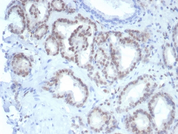IHC staining of FFPE human prostate tissue with Fli1 antibody (clone FLI1/7508). HIER: boil tissue sections in pH 9 10mM Tris with 1mM EDTA for 20 min and allow to cool before testing.~