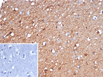 IHC staining of FFPE human brain tissue with Gamma Enolase antibody (clone ENO2/6678). Inset: PBS used in place of primary Ab (secondary Ab negative control). HIER: boil tissue sections in pH 9 10mM Tris with 1mM EDTA for 20 min and allow to cool before testing.~