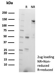 SDS-PAGE analysis of purified, BSA-free CD57 antibody (clone NK1/7566) as confirmation of integrity and purity.