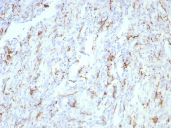 IHC staining of FFPE human tonsil tissue with CD163 antibody (clone rM130/8823). HIER: boil tissue sections in pH 9 10mM Tris with 1mM EDTA for 20 min and allow to cool before testing.~