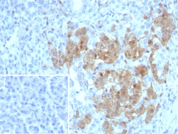 IHC staining of FFPE human pancreas tissue with NSE antibody (clone ENO/8253R). Inset: PBS used in place of primary Ab (secondary Ab negative control). HIER: boil tissue sections in pH 9 10mM Tris with 1mM EDTA for 20 min and allow to cool before testing.~