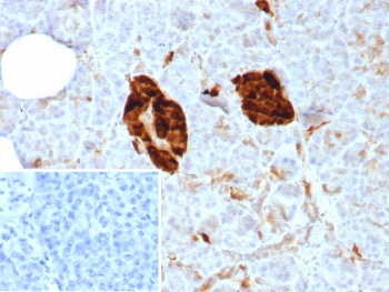 IHC staining of FFPE human pancreas tissue with NSE antibody (clone ENO/8614R). Inset: PBS used in place of primary Ab (secondary Ab negative control). HIER: boil tissue sections in pH 9 10mM Tris with 1mM EDTA for 20 min and allow to cool before testing.~
