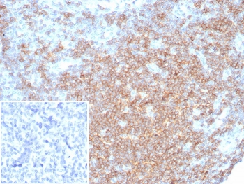 IHC staining of FFPE human lymph node tissue with CD27 antibody (clone LPFS2/8316R). Inset: PBS used in place of primary Ab (secondary Ab negative control). HIER: boil tissue sections in pH 9 10mM Tris with 1mM EDTA for 20 min and allow to cool before testing.~