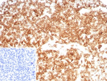 IHC staining of FFPE human tonsil tissue with recombinant CD27 antibody (clone LPFS2/8607R). Inset: PBS used in place of primary Ab (secondary Ab negative control). HIER: boil tissue sections in pH 9 10mM Tris with 1mM EDTA for 20 min and allow to cool before testing.~