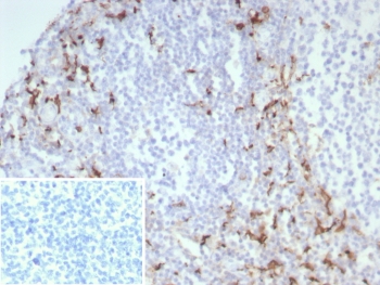 IHC staining of FFPE human tonsil tissue with CD163 a