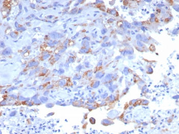 IHC staining of FFPE human bladder tissue with PEIG-1 antibody (clone GPRC5A/7893). HIER: boil tissue sections in pH 9 10mM Tris with 1mM EDTA for 20 min and allow to cool before testing.~