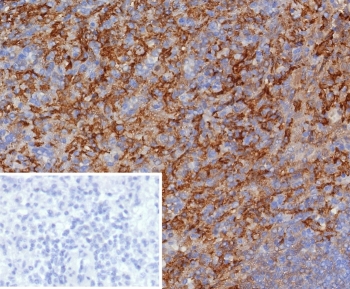 IHC staining of FFPE human spleen tissue w