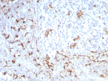IHC staining of FFPE human tonsil tissue with recombinant CD163 antibody (clone M130/8821R). HIER: boil tissue sections in pH 9 10mM Tris with 1mM EDTA for 20 min and allow to cool before testing.~