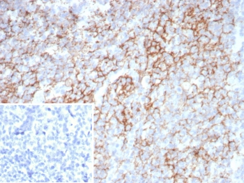 IHC staining of FFPE human tonsil tissue with LAG-3 antibody (clone LAG3/7380). Inset: PBS used in place of primary Ab (secondary Ab negative control). HIER: boil tissue sections in pH 9 10mM Tris with 1mM EDTA for 20 min and allow to cool before testing.~
