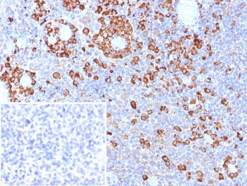 IHC staining of FFPE human tonsil tissue with CD9 antibody (clone CD9/7417). Inset: PBS used in place of primary Ab (secondary Ab negative control). HIER: boil tissue sections in pH 9 10mM Tris with 1mM EDTA for 20 min and allow to cool before testing.~
