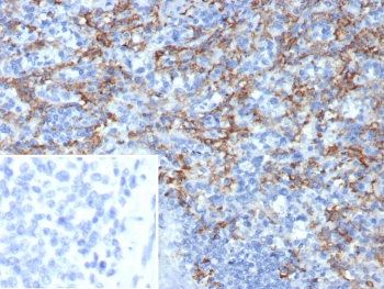 IHC staining of FFPE human spleen tissue with CD163L1 antibody (clone CD163L1/7974). Inset: PBS used in place of primary Ab (secondary Ab negative control). HIER: boil tissue sections in pH 9 10mM Tris with 1mM EDTA for 20 min and allow to cool before testing.~