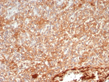 IHC staining of FFPE human spleen tissue with PTPN6 antibody (clone PTPN6/7543). HIER: boil tissue sections in pH 9 10mM Tris with 1mM EDTA for 20 min and allow to cool before testing.~