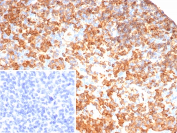 IHC staining of FFPE human tonsil tissue with SHP-1 antibody (clone PTPN6/7544). Inset: PBS used in place of primary Ab (secondary Ab negative control). HIER: boil tissue sections in pH 9 10mM Tris with 1mM EDTA for 20 min and allow to cool before testing.~