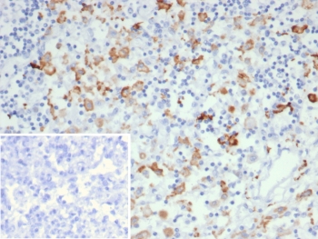 IHC staining of FFPE human lymph node tissue with CD163L1 antibody (clone CD163L1/7971). Inset: PBS used in place of primary Ab (secondary Ab negative control). HIER: boil tissue sections in pH 9 10mM Tris with 1mM EDTA for 20 min and allow to cool before testing.~