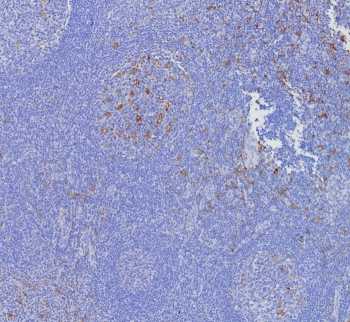 IHC staining of FFPE human tonsil tissue with CD163L1 antibody (clone CD163L1/7972). HIER: boil tissue sections in pH 9 10mM Tris with 1mM EDTA for 20 min and allow to cool before testing.~
