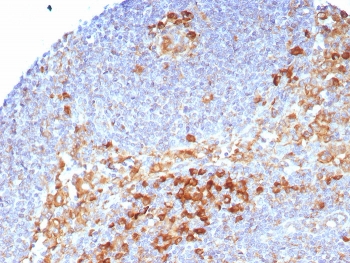 IHC staining of FFPE human lymph node tissue with CD9 antibody (clone CD9/7416). HIER: boil tissue sections in pH 9 10mM Tris with 1mM EDTA for 20 min and allow to cool before testing.~