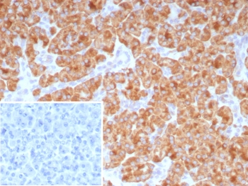 IHC staining of FFPE human pancreas tissue with CD9 a