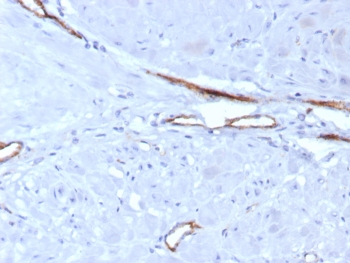 IHC staining of FFPE human uterus tissue with vWF antibody (clone VWF/7979R). HIER: boil tissue sections in pH 9 10mM Tris with 1mM EDTA for 20 min and allow to cool before testing.~