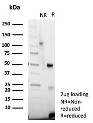 SDS-PAGE analysis of purified, BSA-free vWF antibody (cl