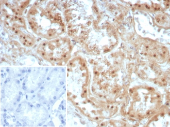 IHC staining of FFPE human kidney tissue with Collagen II antibody (clone COL2A1/8810R). Inset: PBS used in place of primary Ab (secondary Ab negative control). HIER: boil tissue sections in pH 9 10mM Tris with 1mM EDTA for 20 min and allow to cool before testing.~