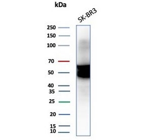 Western blot testing of human SK-BR-3 cell lysate with Cytokeratin-7 antibody (clone KRT7/3733).~