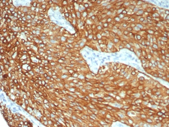 IHC staining of FFPE human lung tissue with