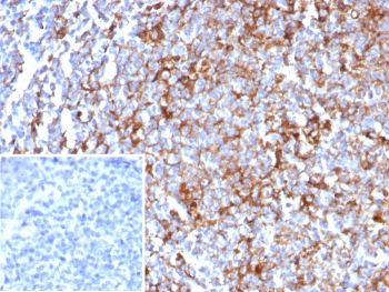 IHC staining of FFPE human tonsil tissue with CD63 antibody (clone rLAMP3/8604). Inset: PBS used in place of primary Ab (secondary Ab negative control). HIER: boil tissue sections in pH 9 10mM Tris with 1mM EDTA for 20 min and allow to cool before testing.~