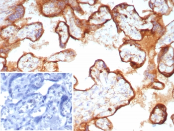 IHC staining of FFPE human placental tissue with CD63 antibody (clone LAMP3/8705R). Inset: PBS used in place of primary Ab (secondary Ab negative control). HIER: boil tissue sections in pH 9 10mM Tris with 1mM EDTA for 20 min and allow to cool before testing.~