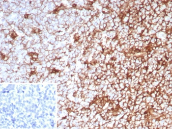 IHC staining of FFPE human tonsil tissue with recombinant CD63 antibody (clone LAMP3/8799R). Inset: PBS used in place of primary Ab (secondary Ab negative control). HIER: boil tissue sections in pH 9 10mM Tris with 1mM EDTA for 20 min and allow to cool before testing.~