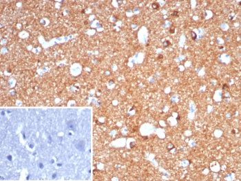 IHC staining of FFPE human brain tissue with CD91 / LRP1 antibody (clone LRP1/7152) Inset: PBS used in place of primary Ab (secondary Ab negative control). HIER: boil tissue sections in pH 9 10mM Tris with 1mM EDTA for 20 min and allow to cool before testing.~