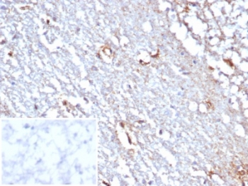 IHC staining of FFPE human cerebellum tissue with STAT6 antibody (clone STAT6/7774R). Inset: PBS used in place of primary Ab (secondary Ab negative control). HIER: boil tissue sections in pH 9 10mM Tris with 1mM EDTA for 20 min and allow to cool before testing.~
