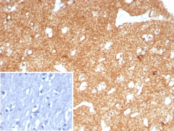 IHC staining of FFPE human brain tissue with recombinant A2MR antibody (clone LRP1/8771R) Inset: PBS used in place of primary Ab (secondary Ab negative control). HIER: boil tissue sections in pH 9 10mM Tris with 1mM EDTA for 20 min and allow to cool before testing.~